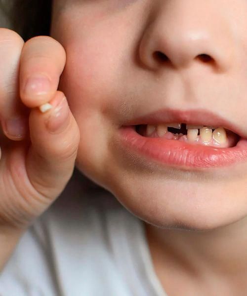 دندان شیری کی می افتد