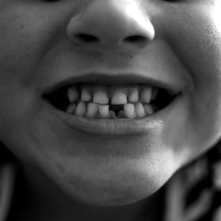 مراقبت از دندان شیری کودکان