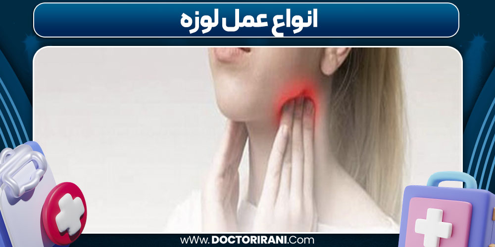 انواع عمل لوزه 