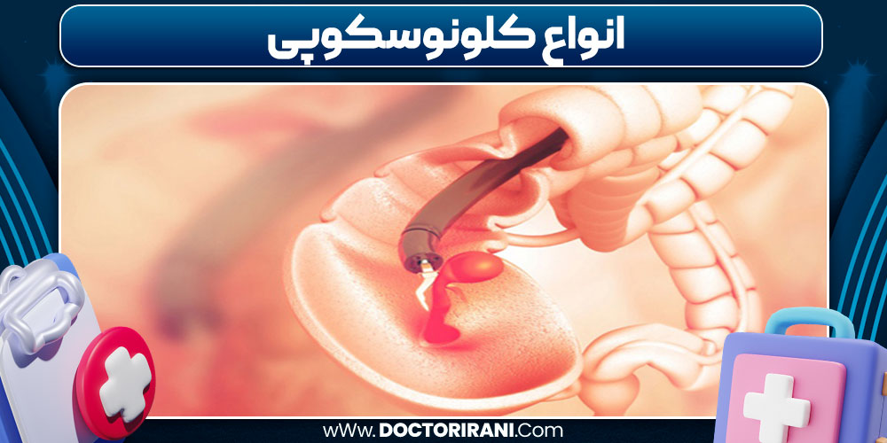 انواع کلونوسکوپی 