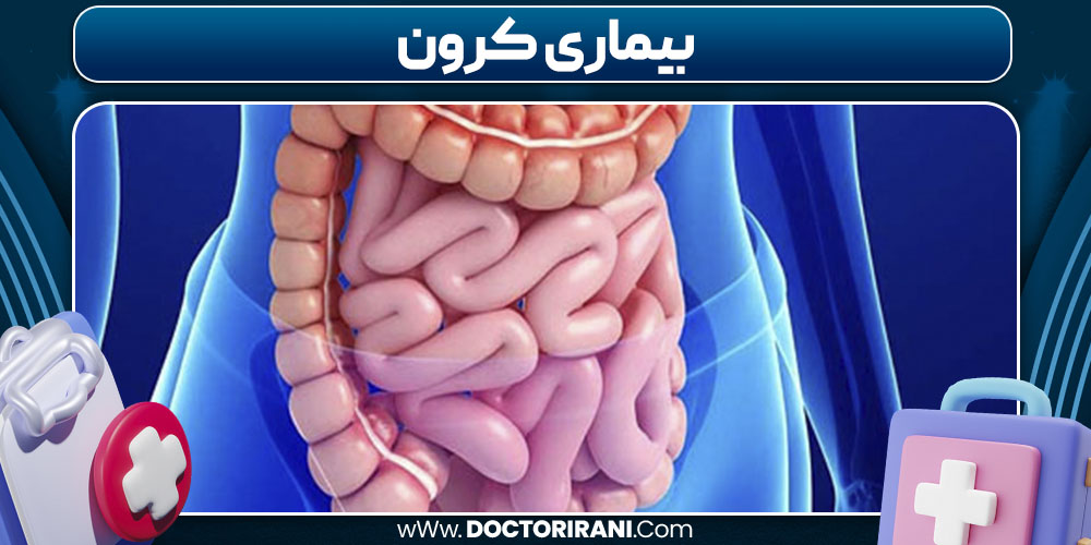 بیماری کرون