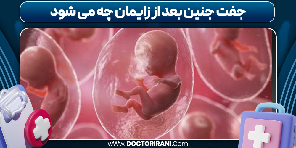جفت جنین بعد از زایمان چه می شود