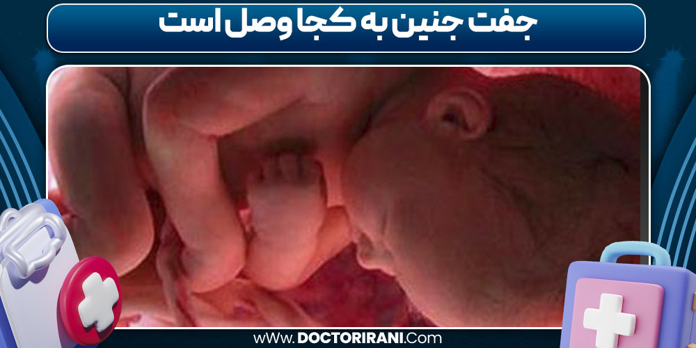 جفت جنین به کجا وصل است