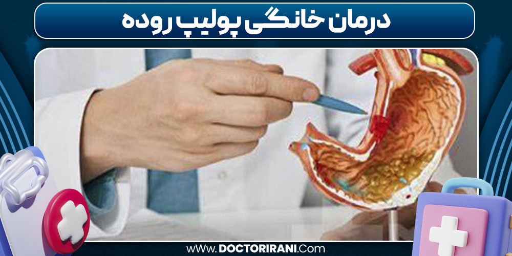 درمان خانگی پولیپ روده