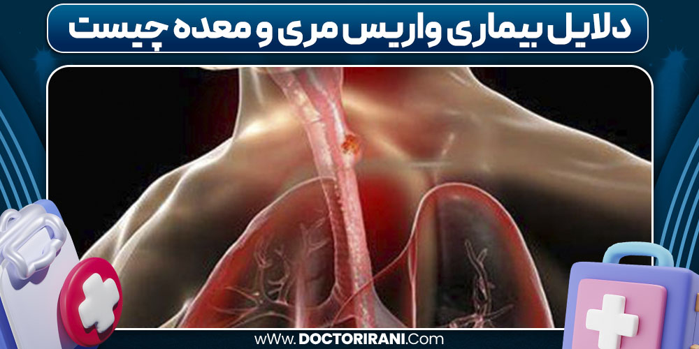 دلایل بیماری واریس مری و معده چیست