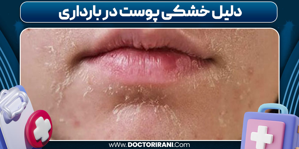 دلیل خشکی پوست در بارداری 