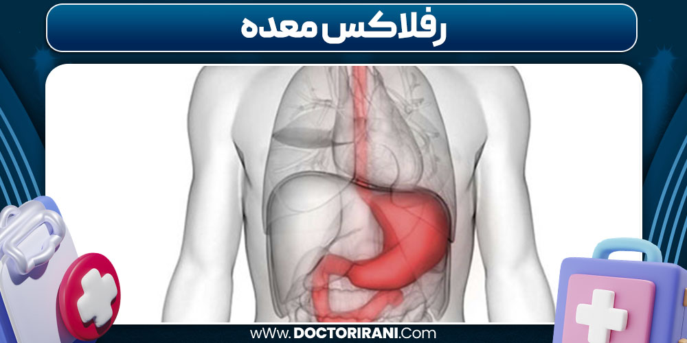 رفلاکس معده