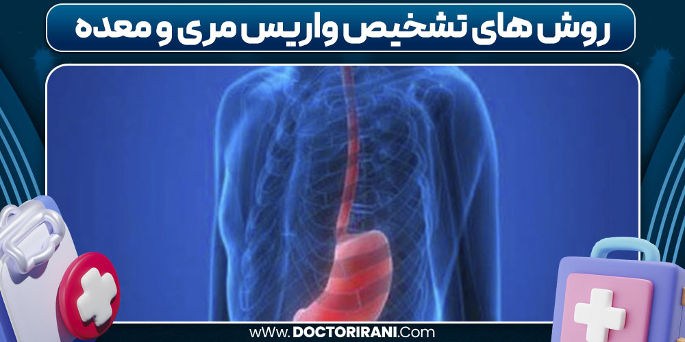 روش های تشخیص واریس مری و معده