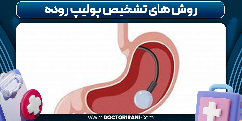روش های تشخیص پولیپ روده