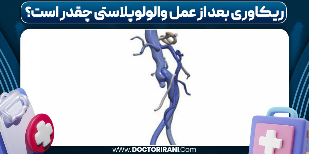ریکاوری بعد از عمل والولوپلاستی چقدر است؟