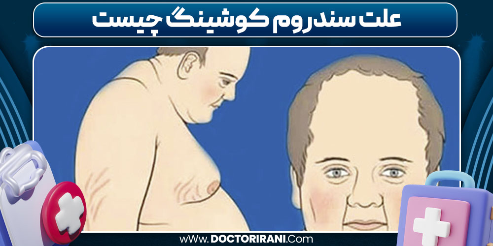 علت سندروم کوشینگ چیست
