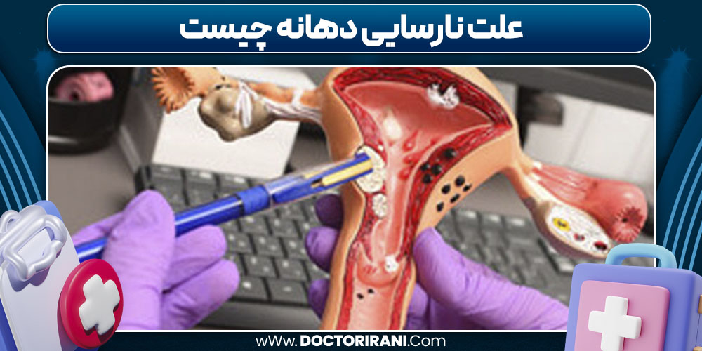 علت نارسایی دهانه چیست