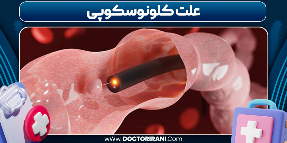 علت کلونوسکوپی
