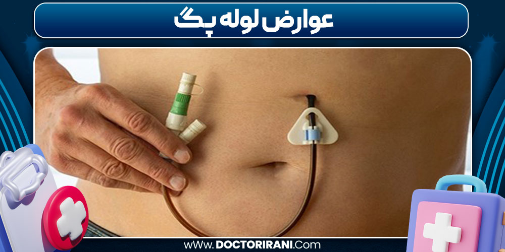 عوارض لوله پگ 