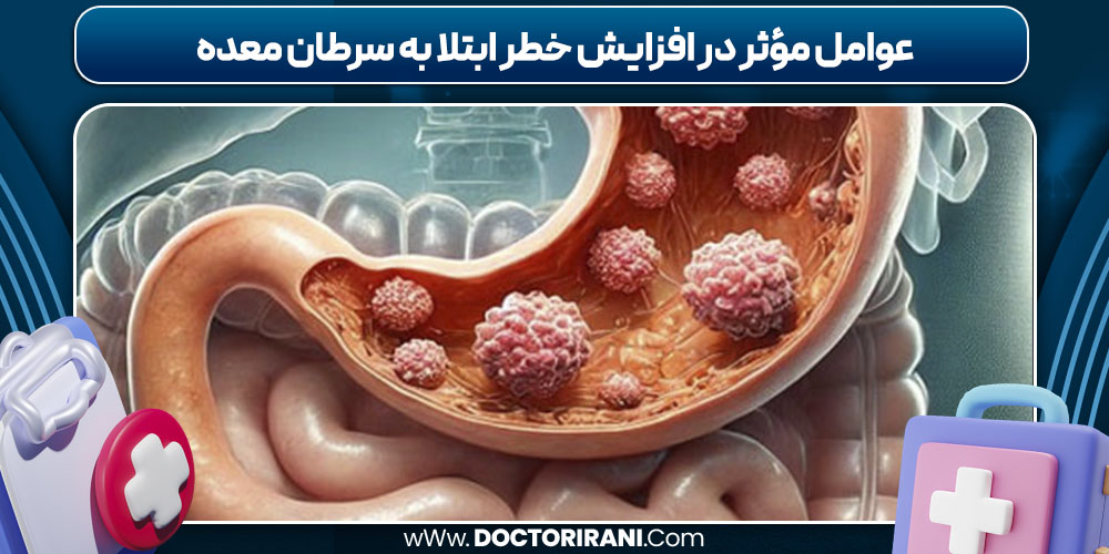 عوامل مؤثر در افزایش خطر ابتلا به سرطان معده