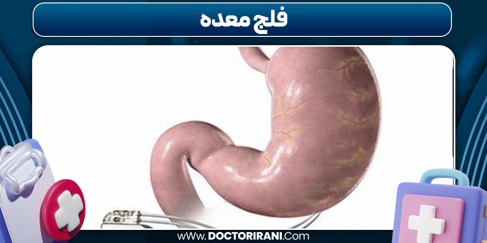 فلج معده