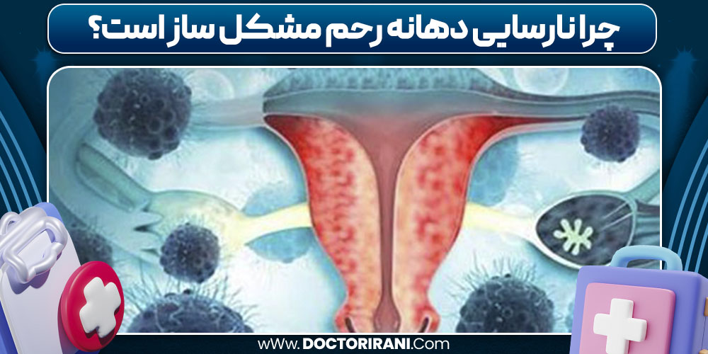 چرا نارسایی دهانه رحم مشکل ساز است؟