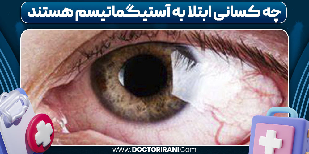 چه کسانی ابتلا به آستیگماتیسم هستند