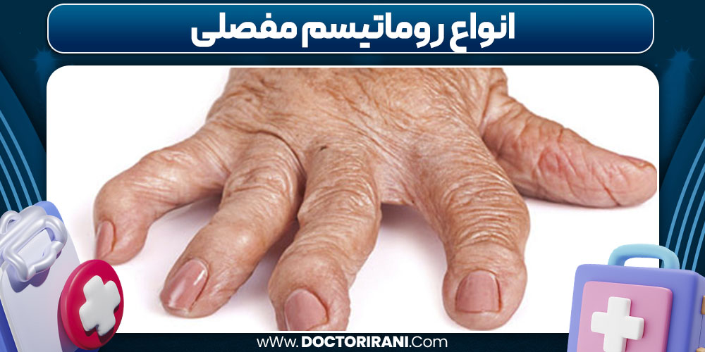 انواع روماتیسم مفصلی انواع روماتیسم مفصلی