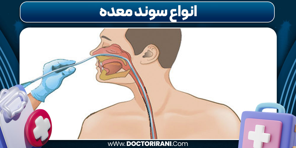 انواع سوند معده