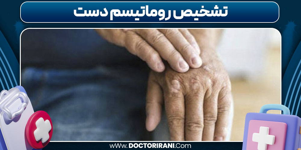 تشخیص روماتیسم دست