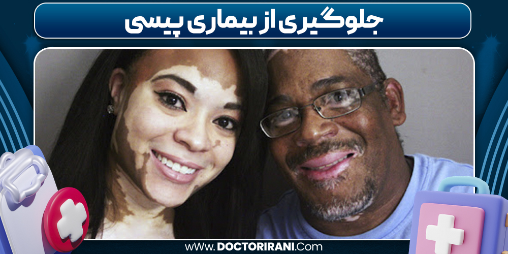 جلوگیری از بیماری پیسی