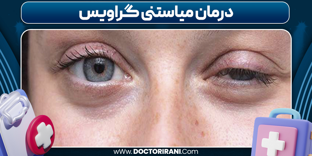 درمان میاستنی گراویس