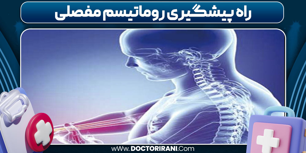 راه پیشگیری روماتیسم مفصلی راه پیشگیری روماتیسم مفصلی