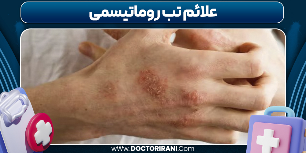 علائم تب روماتیسمی