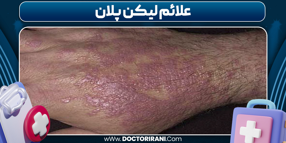 علائم لیکن پلان