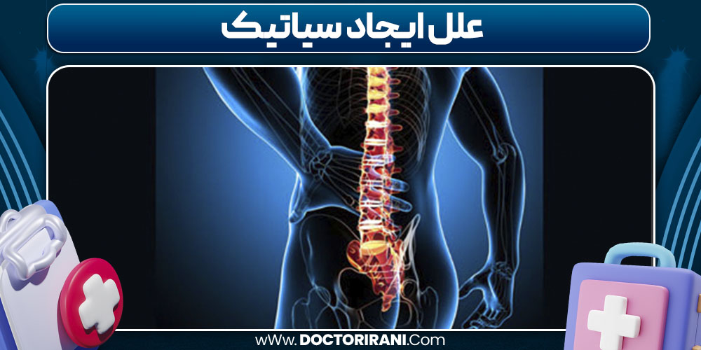 علل ایجاد سیاتیک 