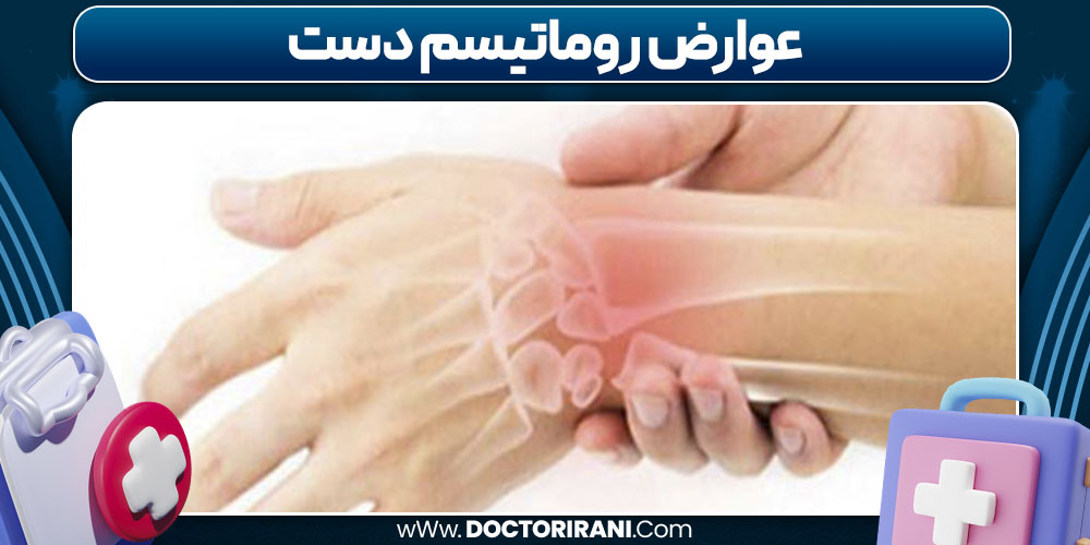 عوارض روماتیسم دست