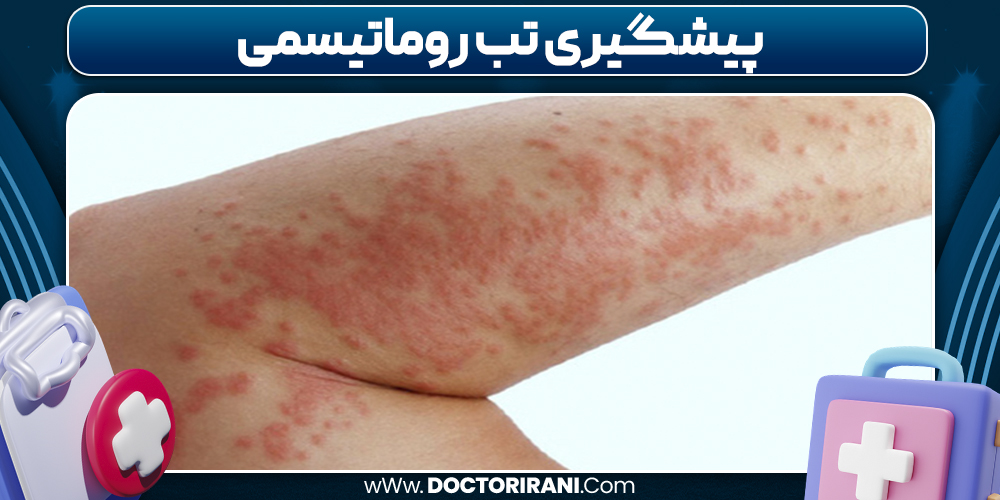 پیشگیری تب روماتیسمی