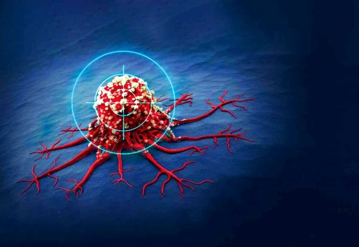 درمان سرطان پوست درمان سرطان پوست