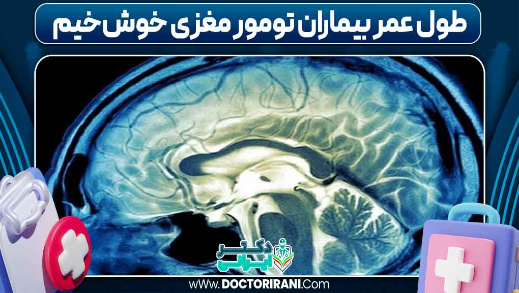 طول عمر بیماران تومور مغزی خوش‌خیم
