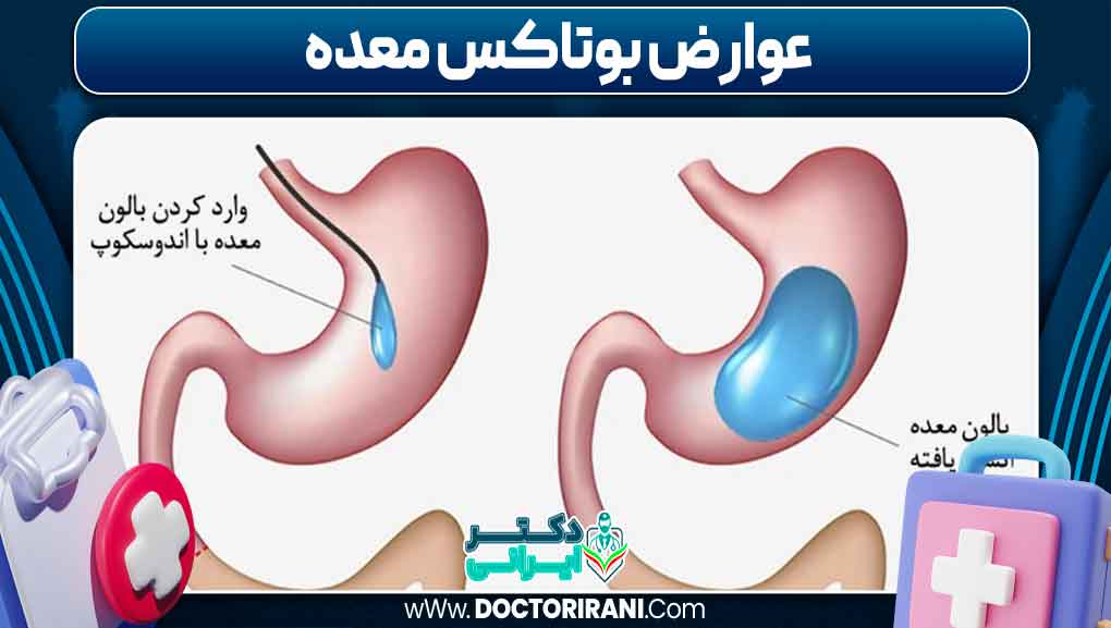 عوارض بوتاکس معده