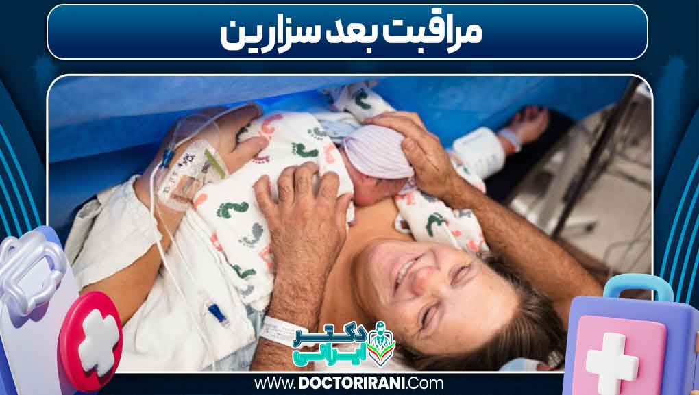 مراقبت بعد سزارین
