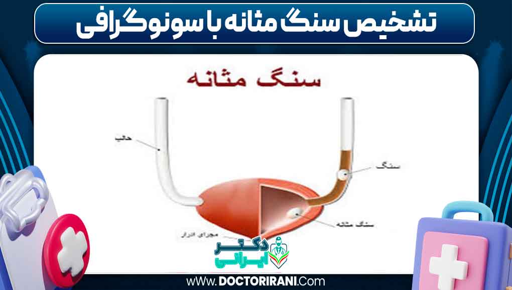 تشخیص سنگ مثانه با سونوگرافی