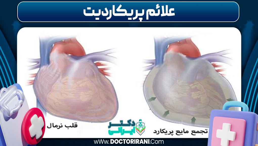 علائم پریکاردیت