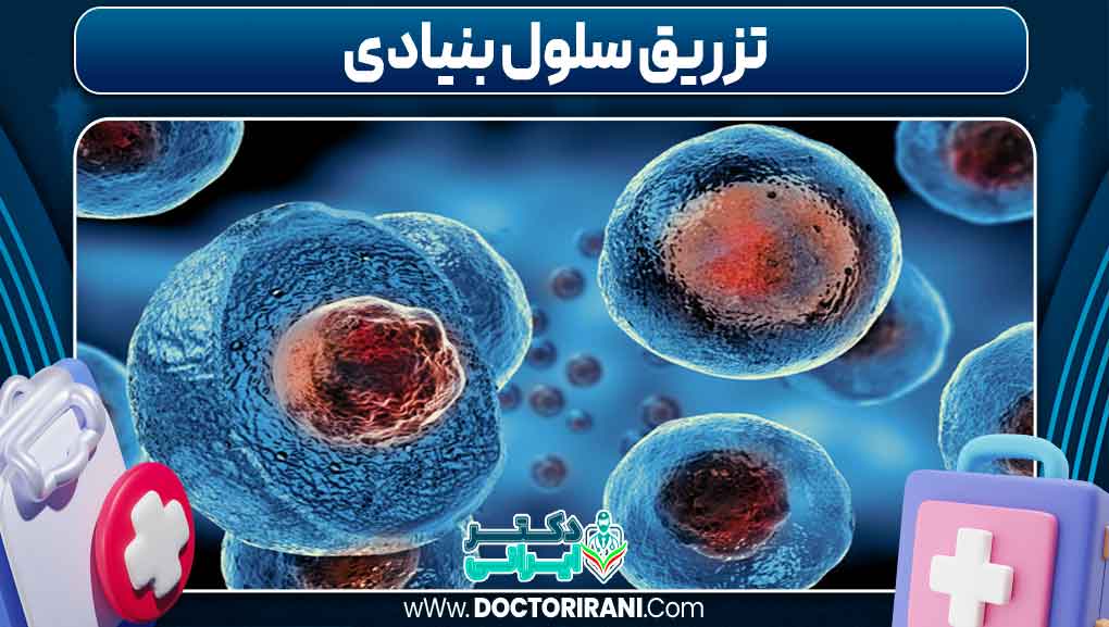 تزریق سلول بنیادی