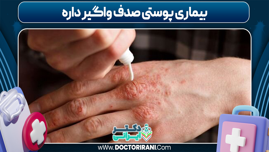 بیماری پوستی صدف واگیر داره