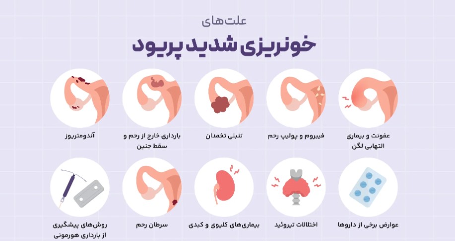 خونریزی شدید پریودی در دختران