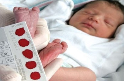 آزمایش غربالگری نوزادان نارس