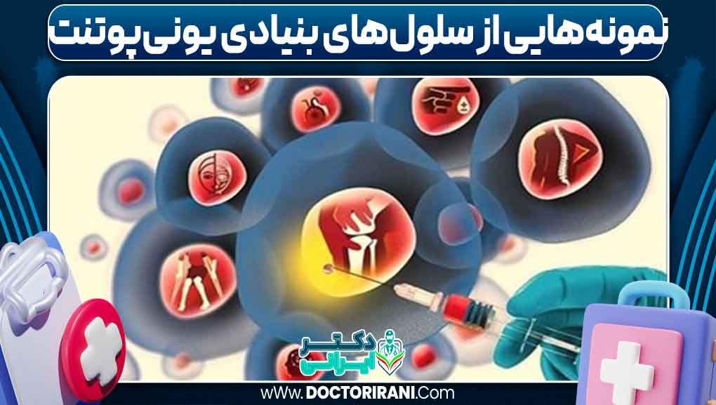 نمونه‌هایی از سلول‌های بنیادی یونی‌پوتنت