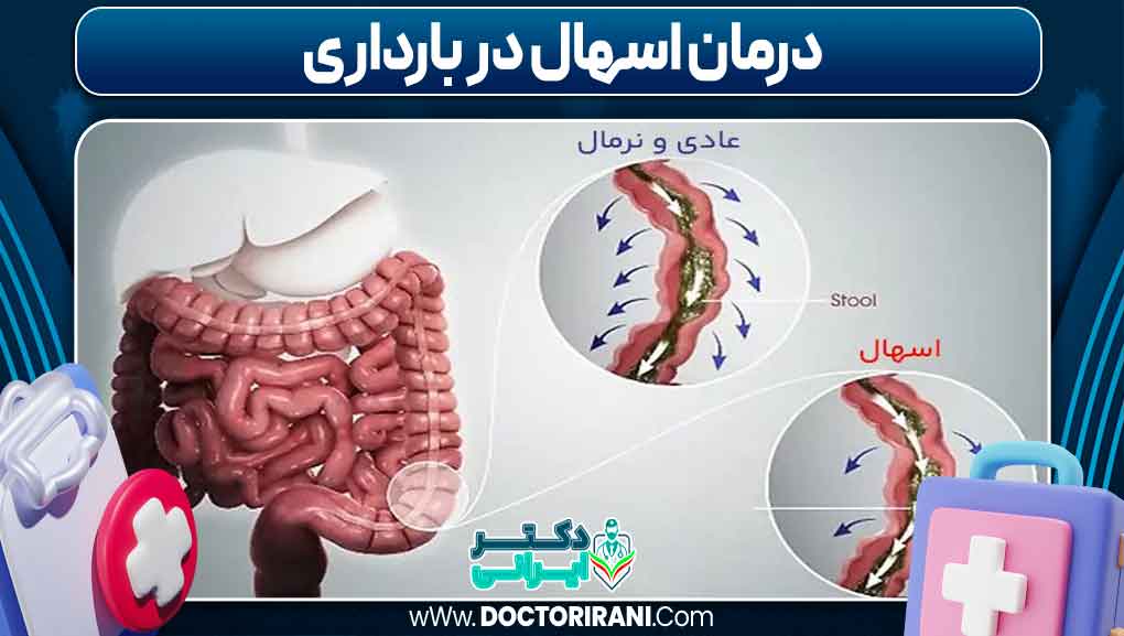 درمان اسهال در بارداری _ دکتر ایرانی درمان اسهال در بارداری
