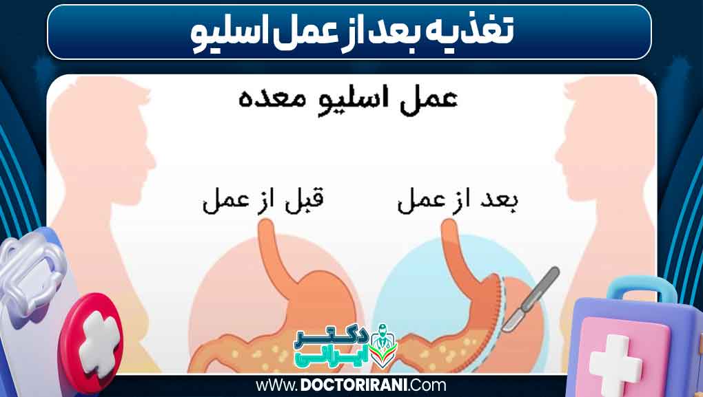 تغذیه بعد از عمل اسلیو