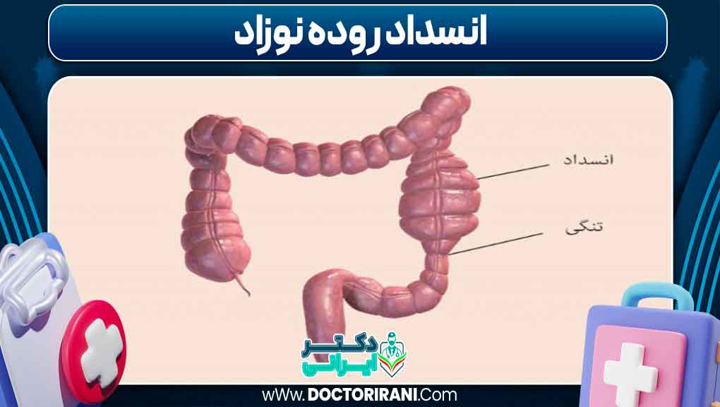 انسداد روده نوزاد