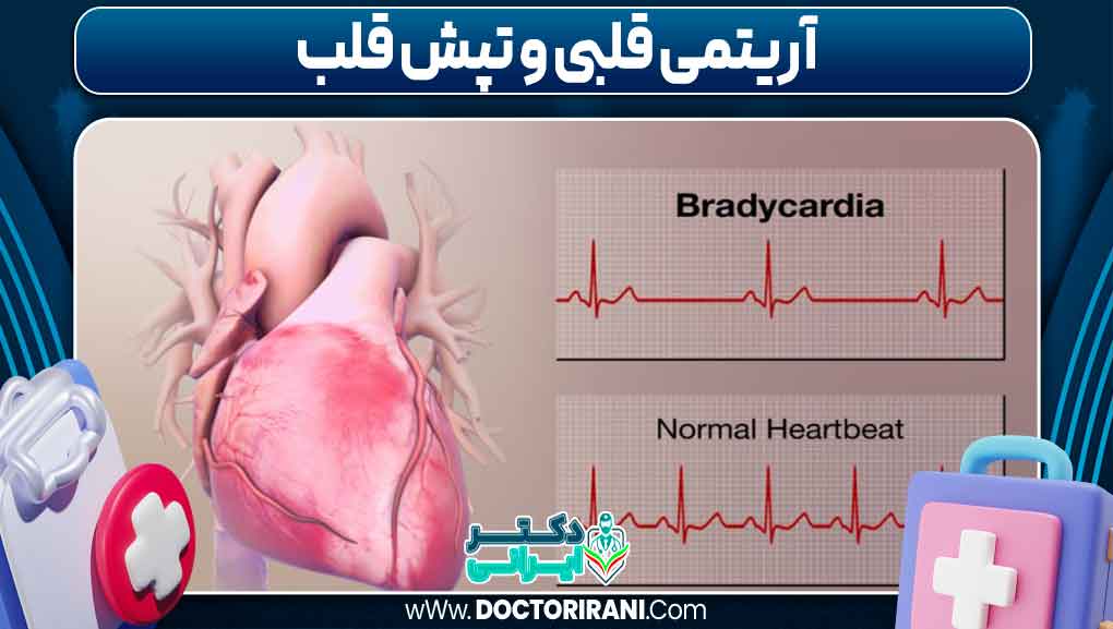 آریتمی قلبی و تپش قلب