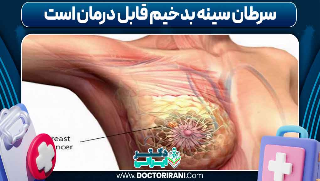سرطان سینه بدخیم قابل درمان است