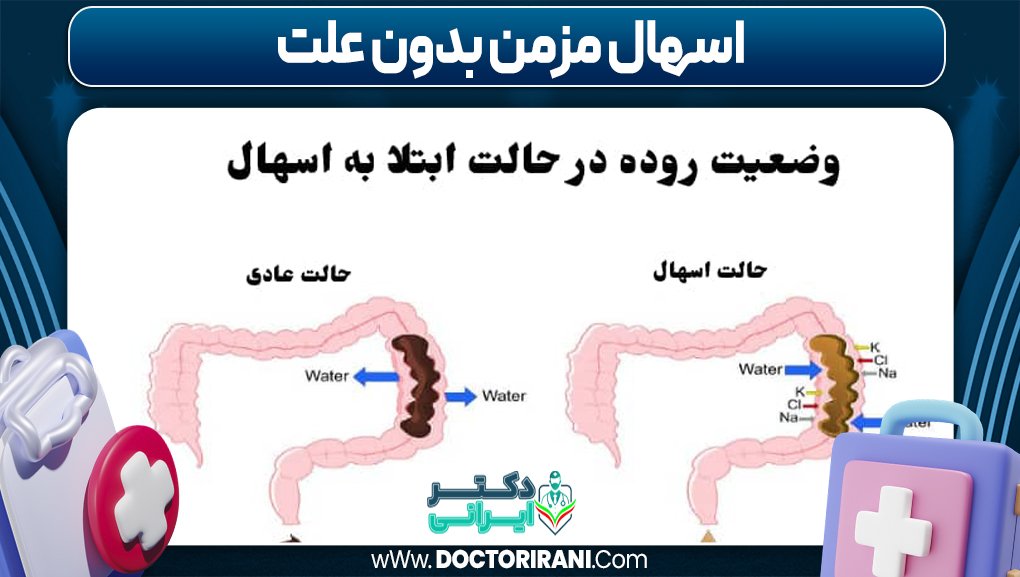 اسهال مزمن بدون علت